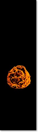 Toxic metal islet of Langerhans