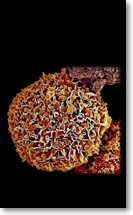 Metalloestrogen breast cancer cell