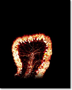 Purkinje cell toxic metal