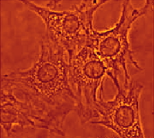 Firefly antibody permeabolized by Triton X-100