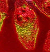 HeLa cells permeabolized by Triton 100-X