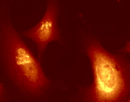 HeLa cells permeabolized by Triton X-100