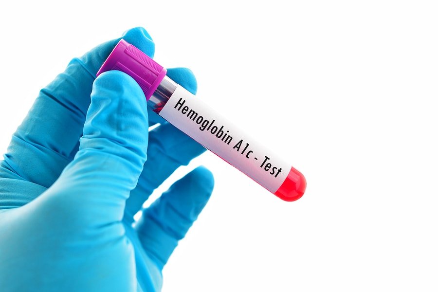 HbA1c Test