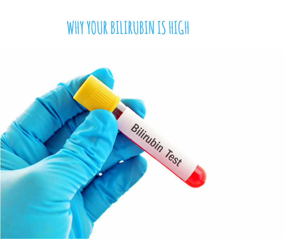 Bilirubin test