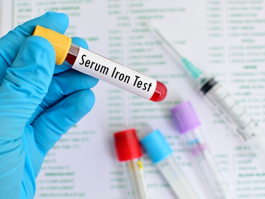 Iron blood test