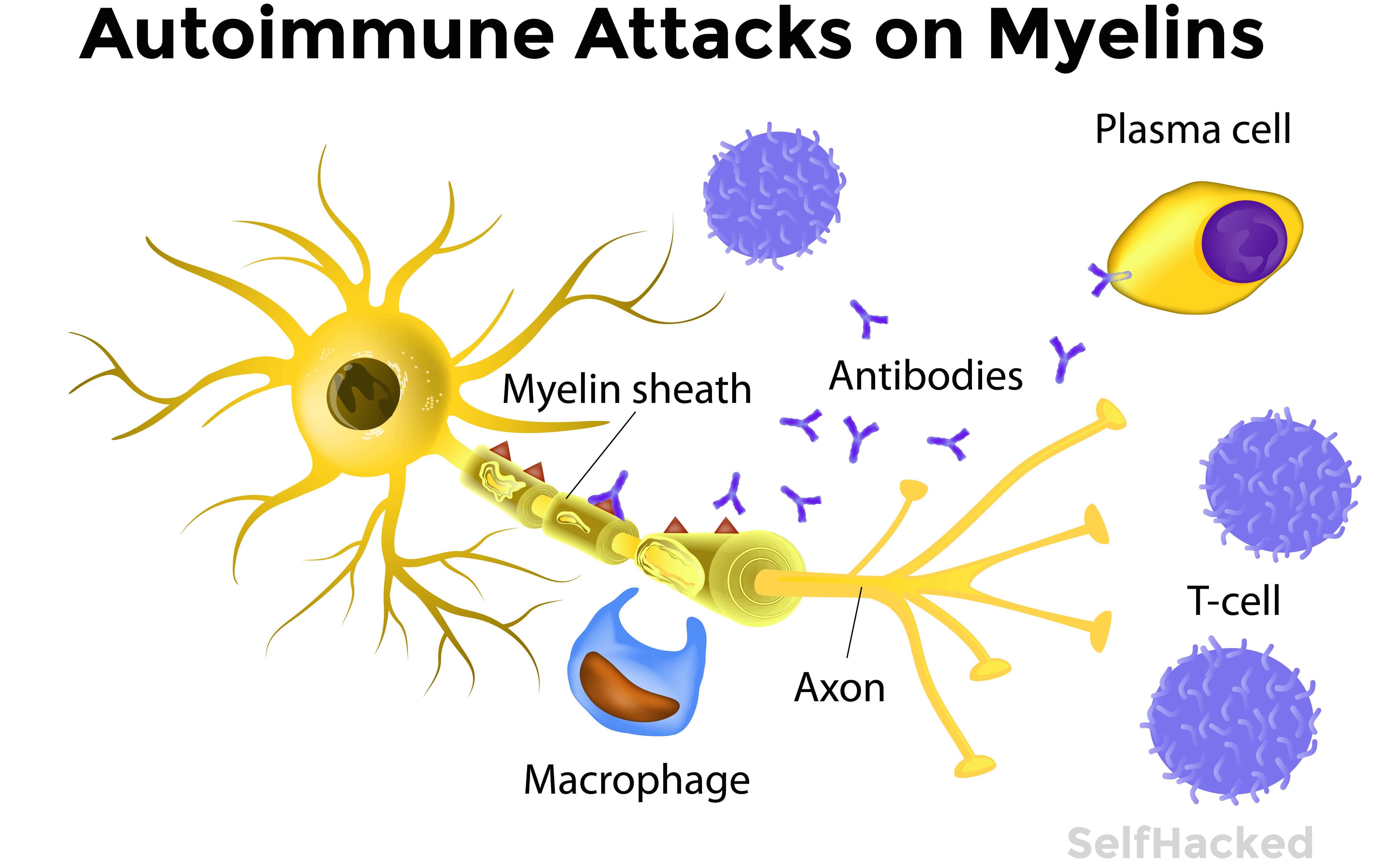 Nerve damage