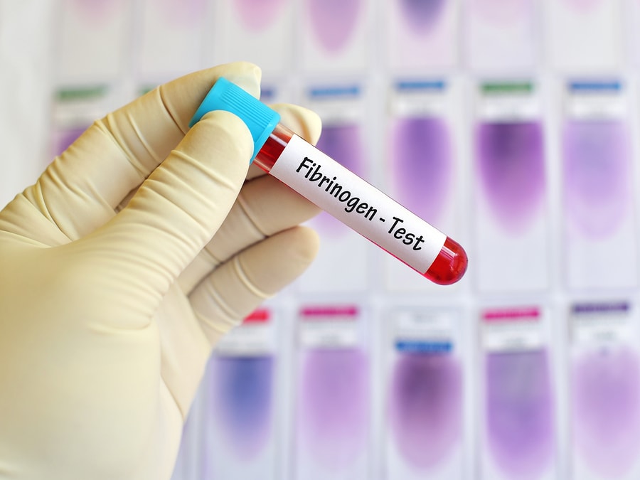 Fibrinogen