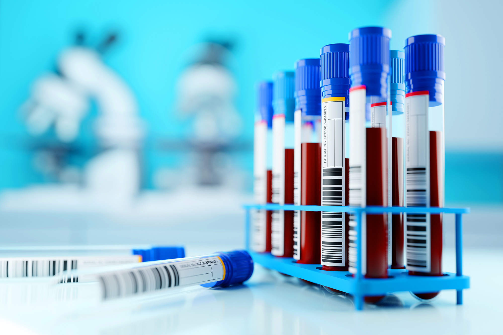 9 lab tests to check your immune system