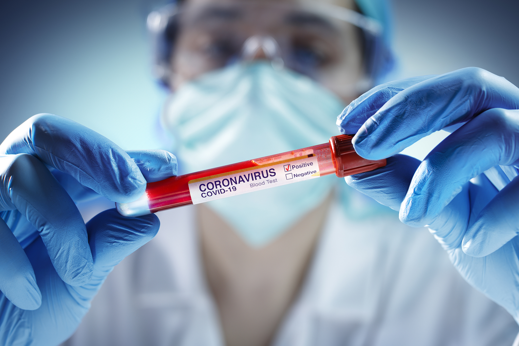 Lab tests & COVID-19